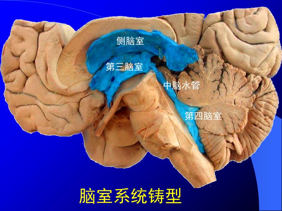 《脑室脑池》PPT课件_第3页