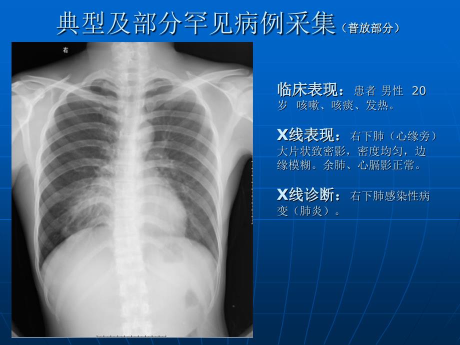 典型及部分罕见病例采集_第2页