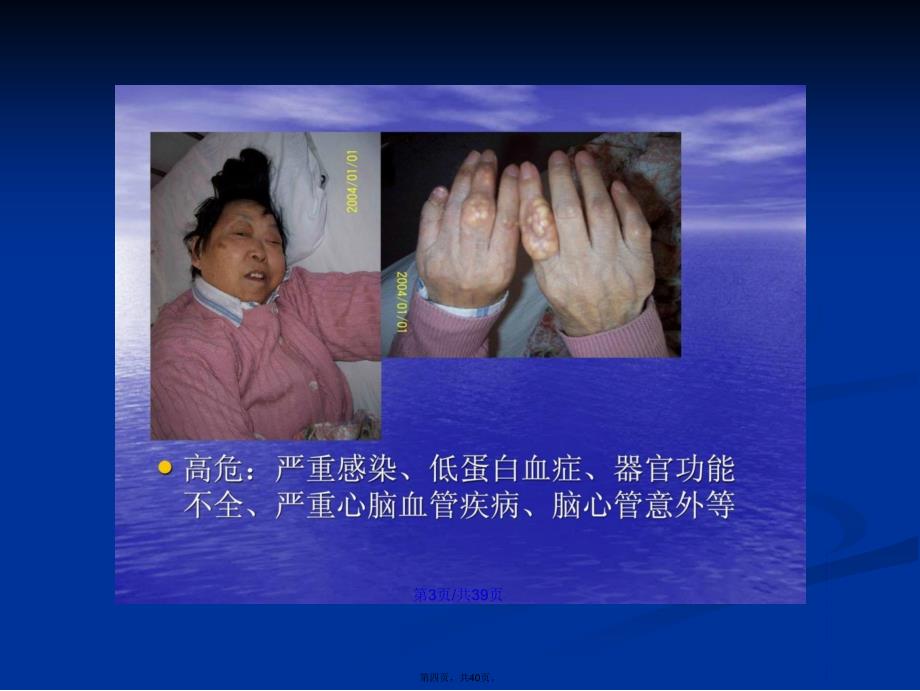 精华一月快速康复外科处理高危人群的关节置换手术学习教案_第4页