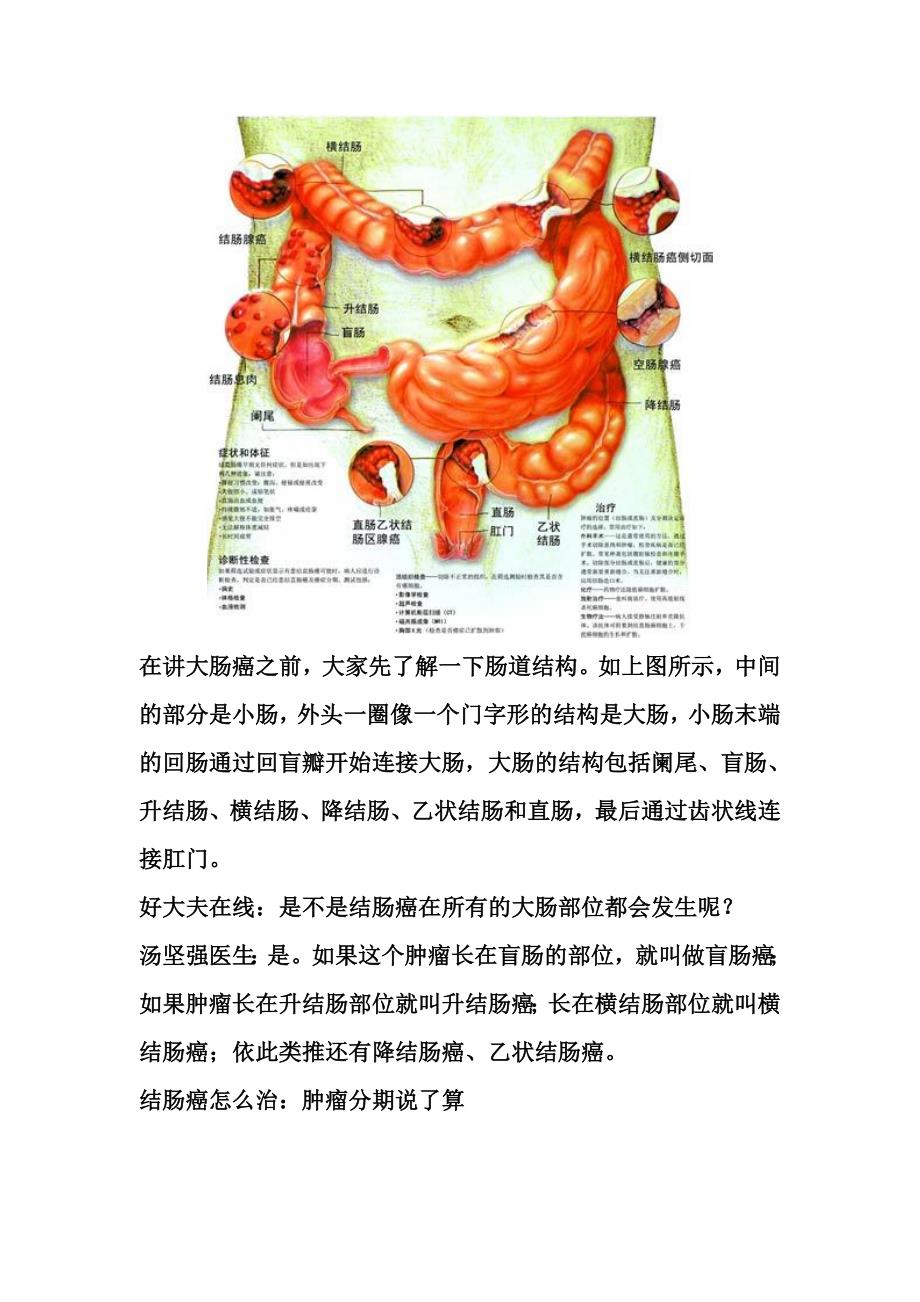 早期结肠癌治愈率可达_第2页