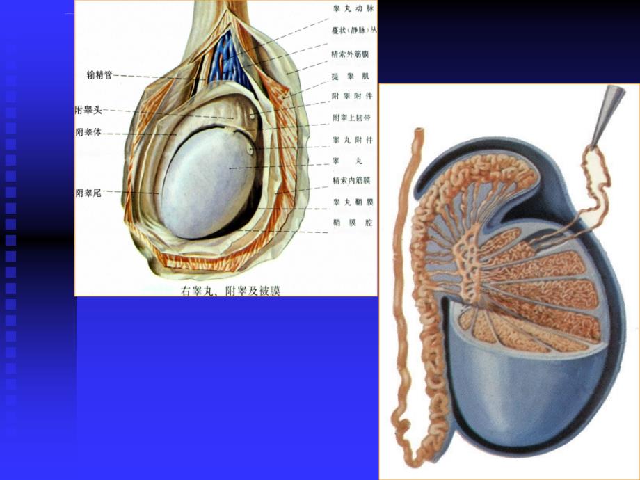 阴囊的超声检查ppt课件_第4页