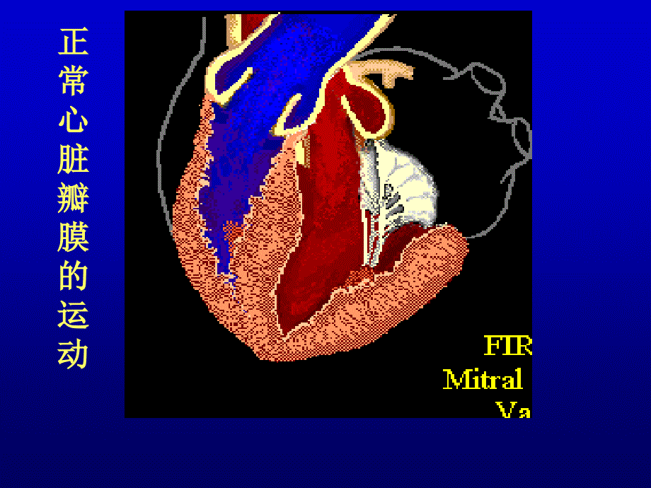 心-脏-瓣-膜-病课件_第4页