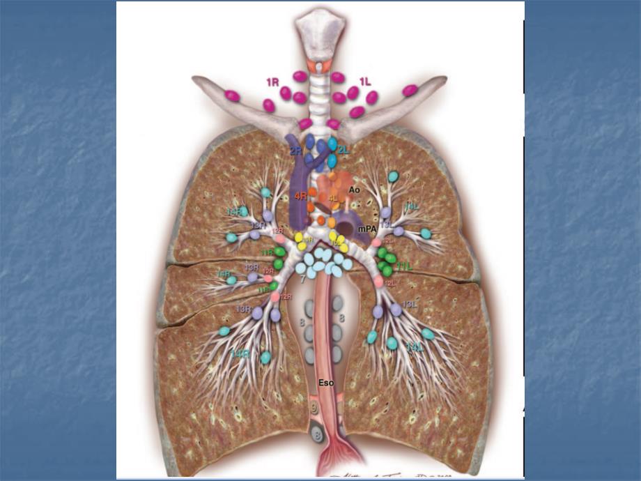 肺部淋巴结分组勾画幻灯1_第4页
