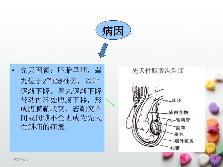 腹股沟疝术后护理_第5页