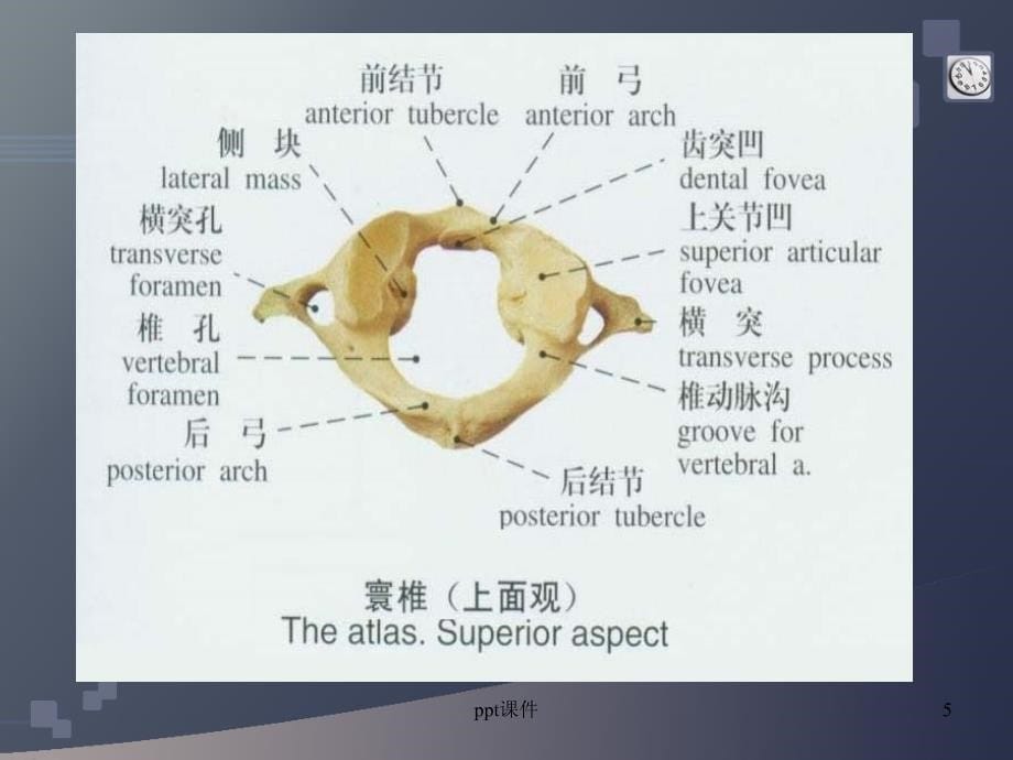 颈椎病的CT诊断ppt课件_第5页