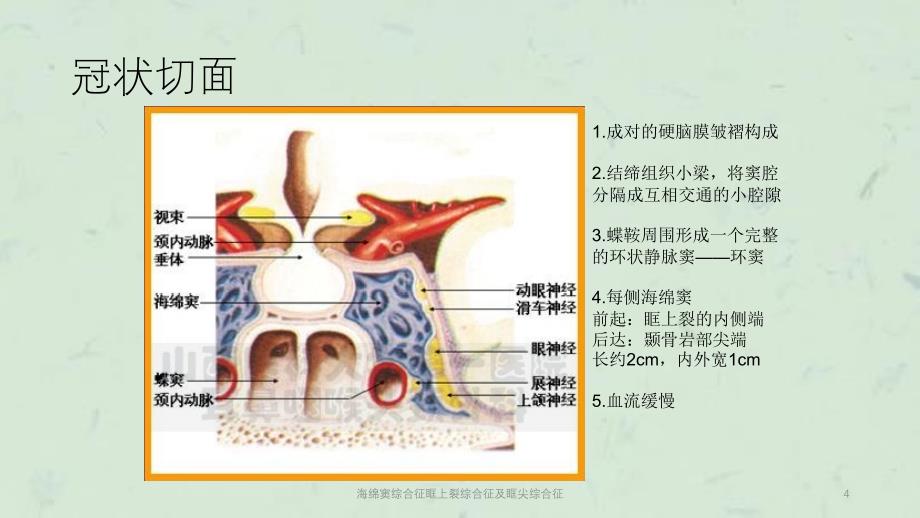 海绵窦综合征眶上裂综合征及眶尖综合征课件_第4页