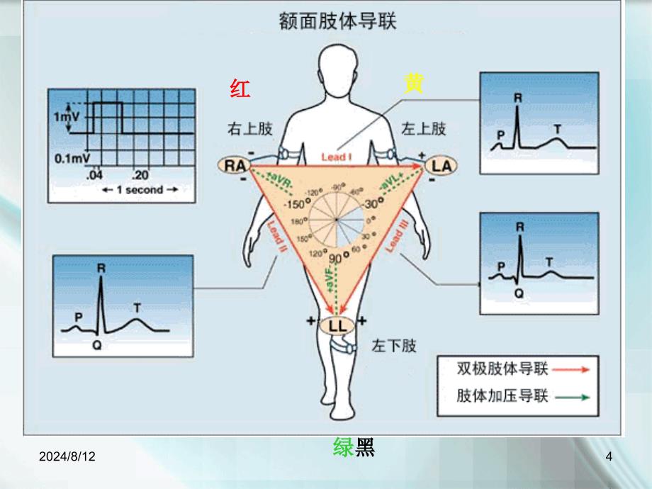 常见心律失常的识别与处理.ppt_第4页