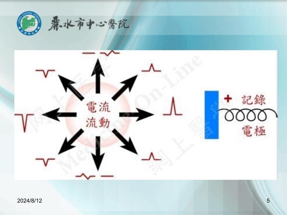 常见心律失常的识别与处理.ppt_第5页