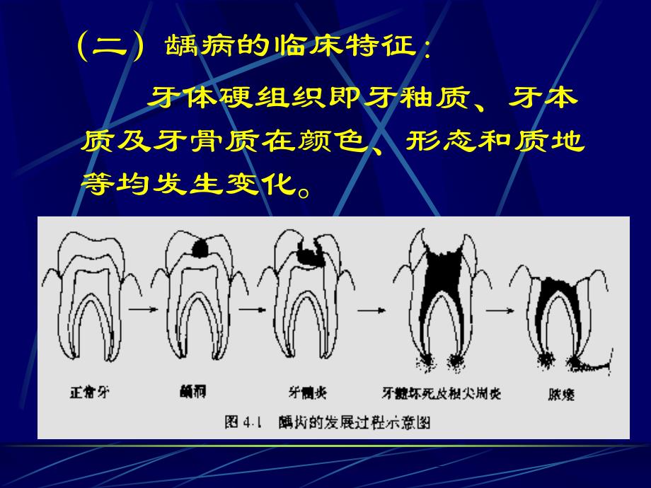 牙体牙髓病PPT通用课件_第3页