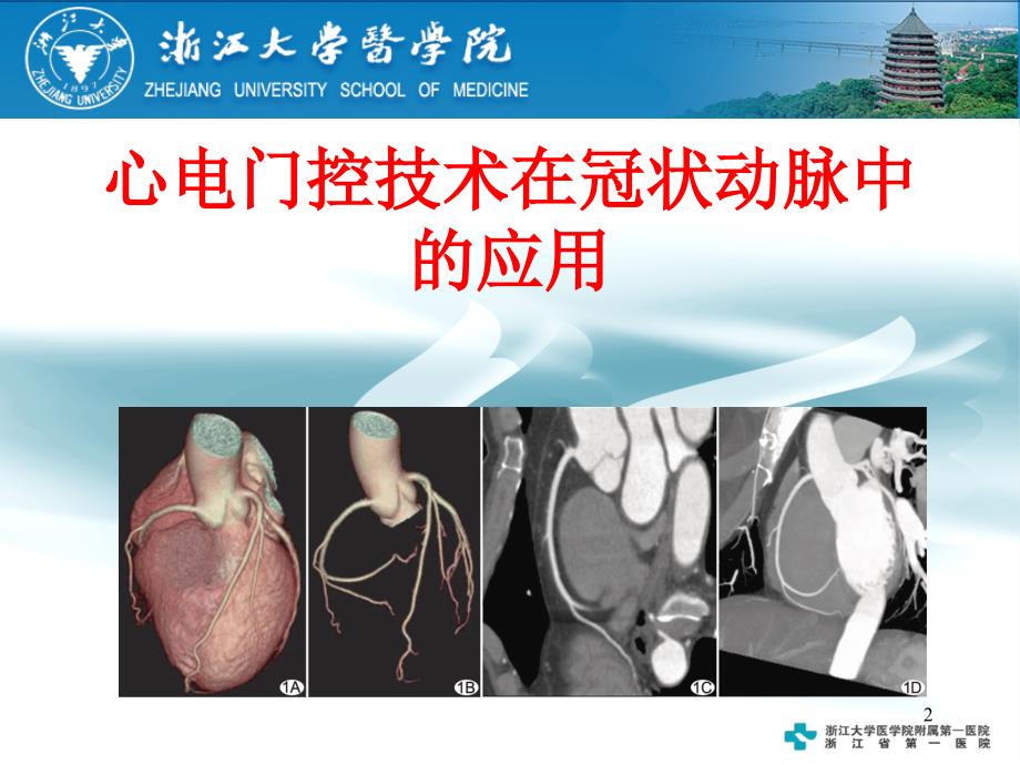 心电门控技术在冠脉中的应用_第2页