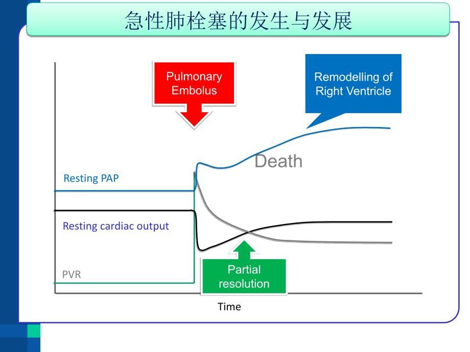 急性肺栓塞与急性右心衰竭_第3页