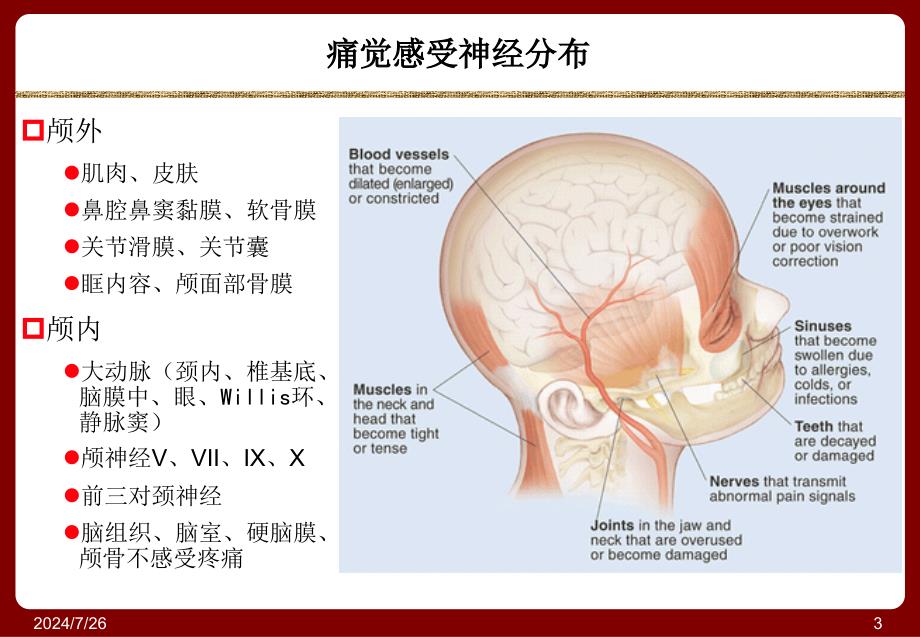 头痛与面部疼痛课件_第3页