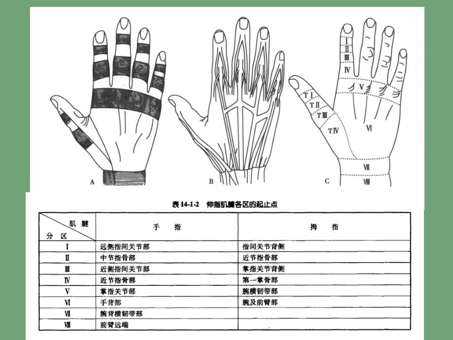 支具在锤状指康复中的应用_第3页