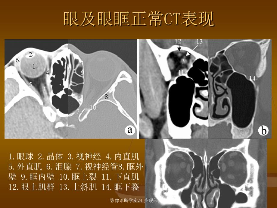 影像诊断学实习头颈部实习课件_第3页