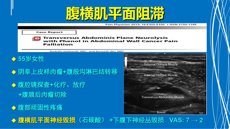 腹部神经阻滞应用解剖沙龙专家知识_第3页