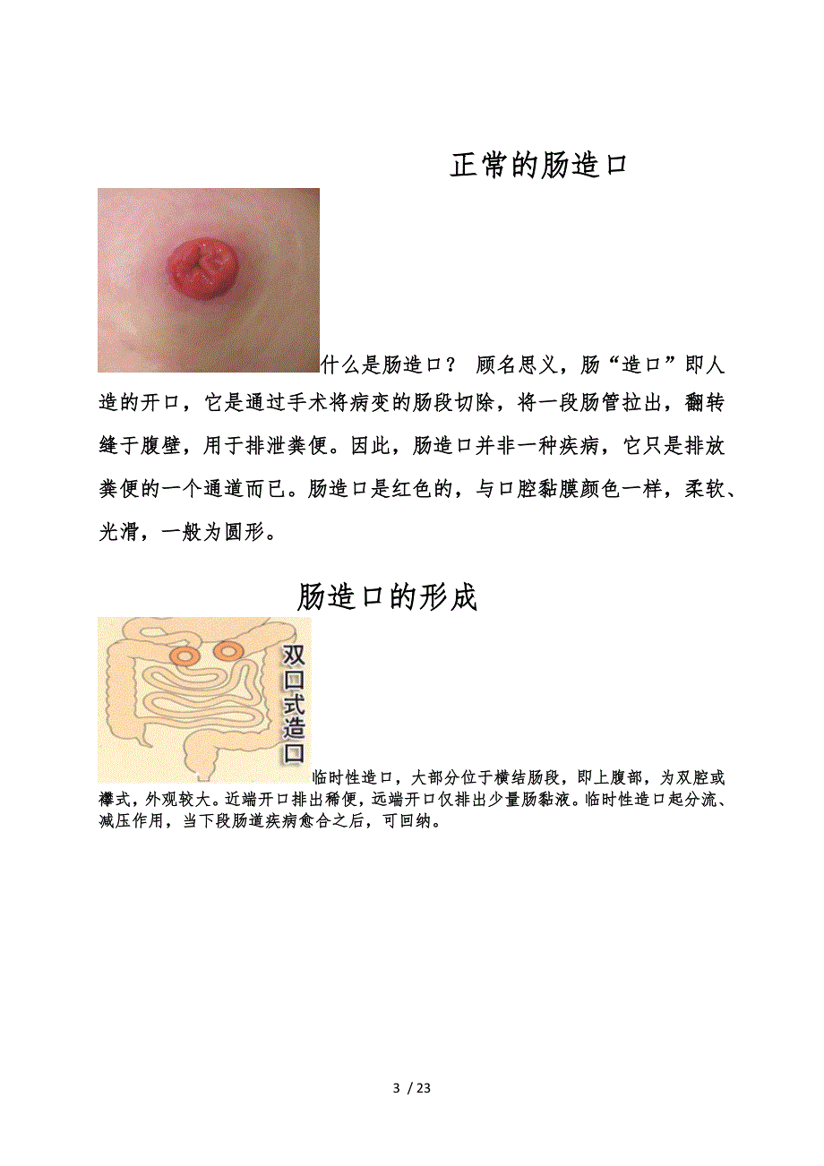 带你认识肠造口宣传册_第3页