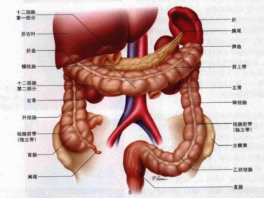 结肠癌ppt课件_第5页