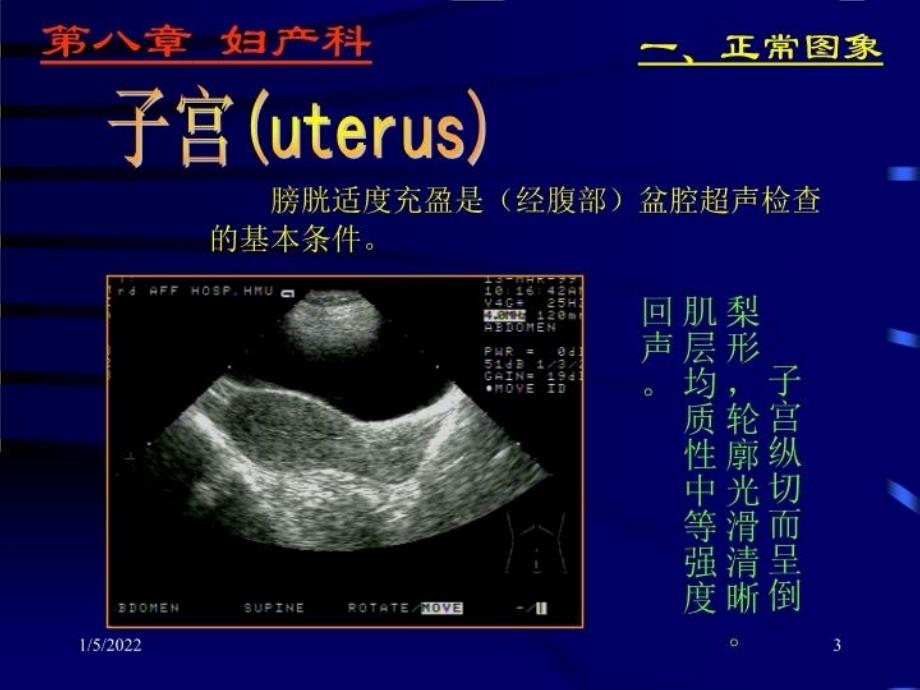 上海交大妇产超声_第3页