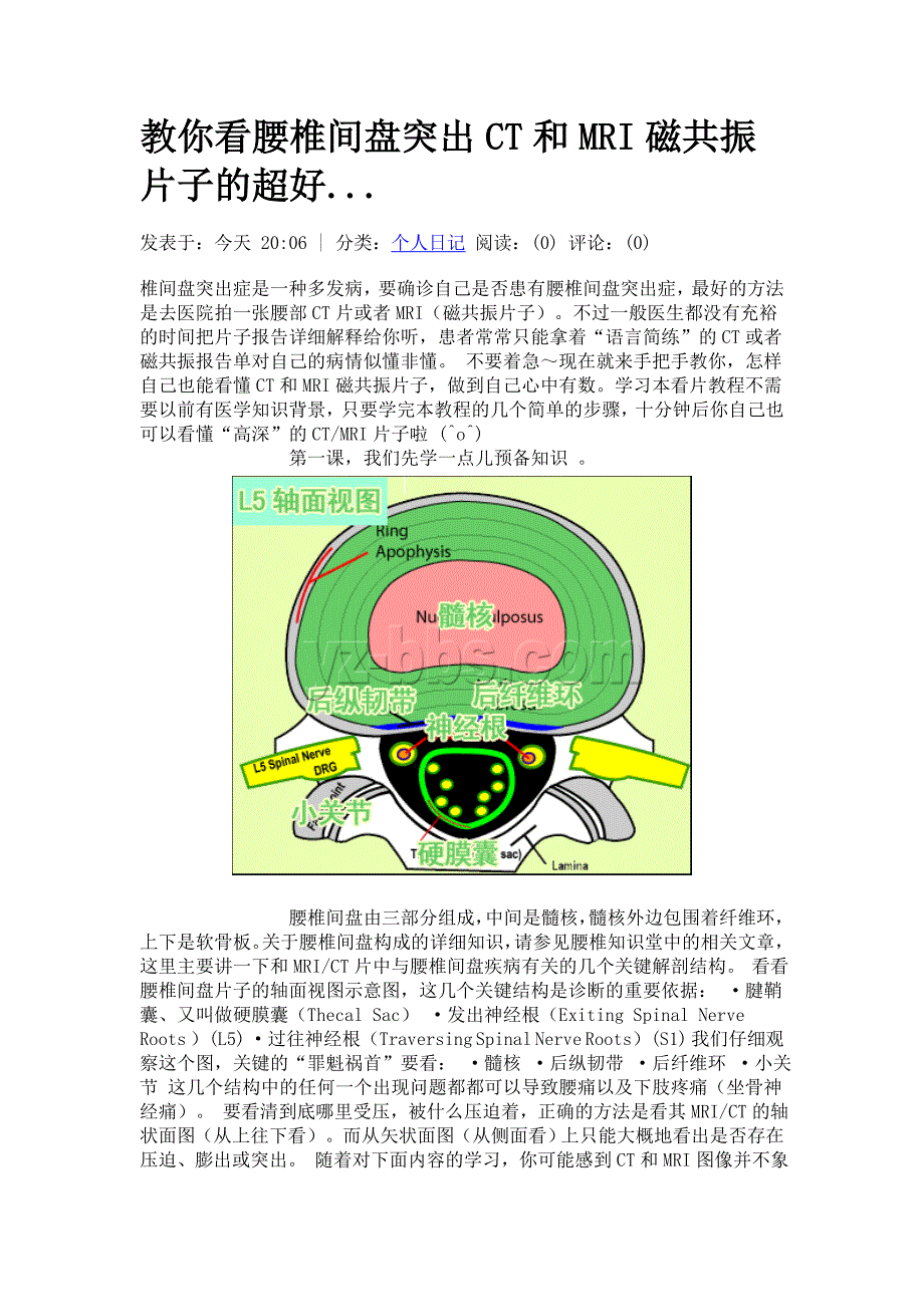 教你看腰椎间盘突出CT和MRI磁共振片子的超好.doc_第1页