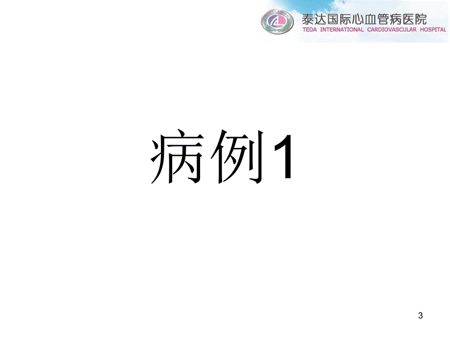 流出道室早消融体表心电图提供的决策_第3页