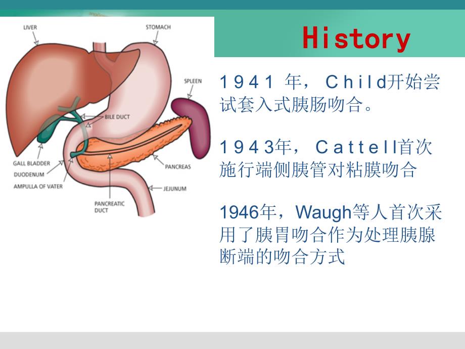 《胰肠吻合方式》PPT课件_第4页