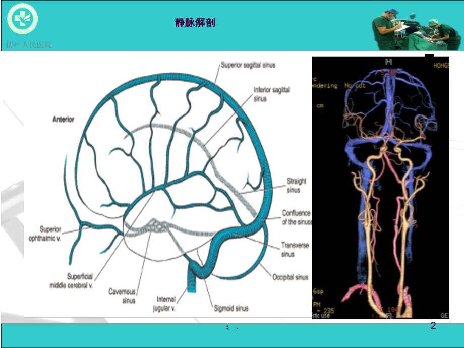 脑血管疾病CTA诊断ppt课件_第2页