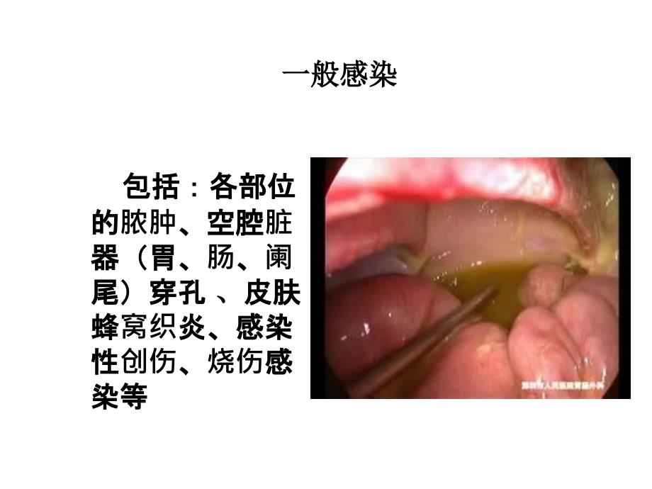 感染手术处理Ppt完整版课件_第4页