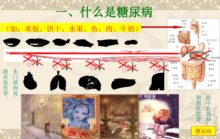 医学专题：有关糖尿病知识PPT_第2页