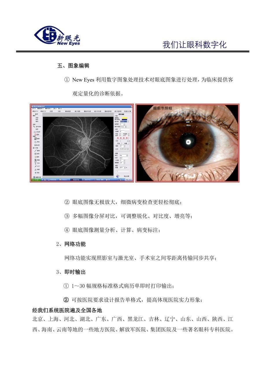 CANON-6OU眼底相机技术方案.doc_第5页