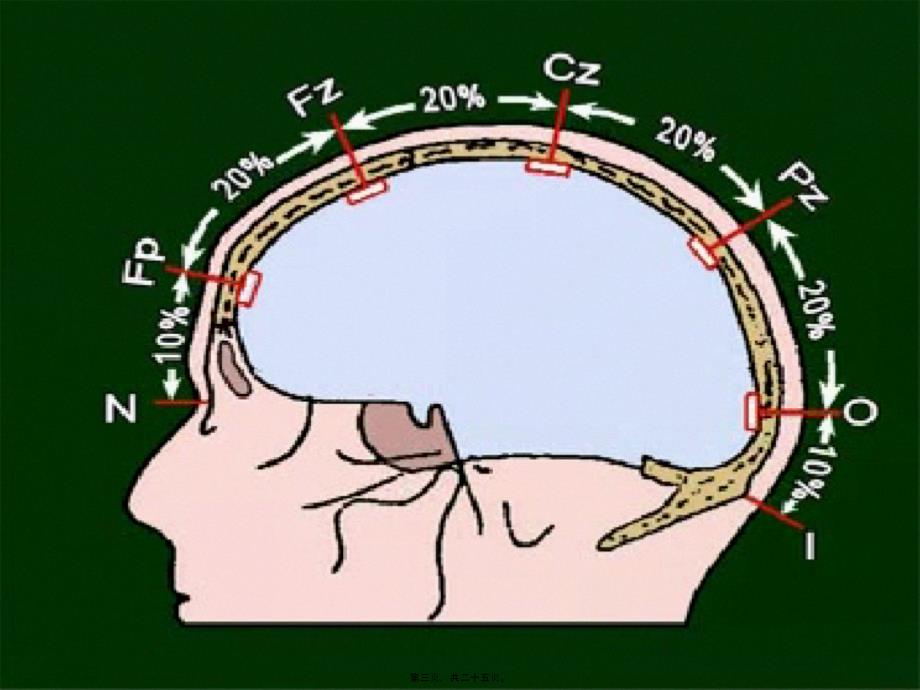 脑电图的基本知识课件_第3页