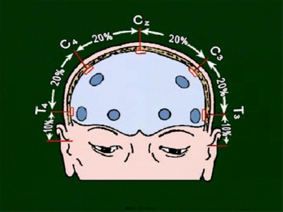 脑电图的基本知识课件_第4页