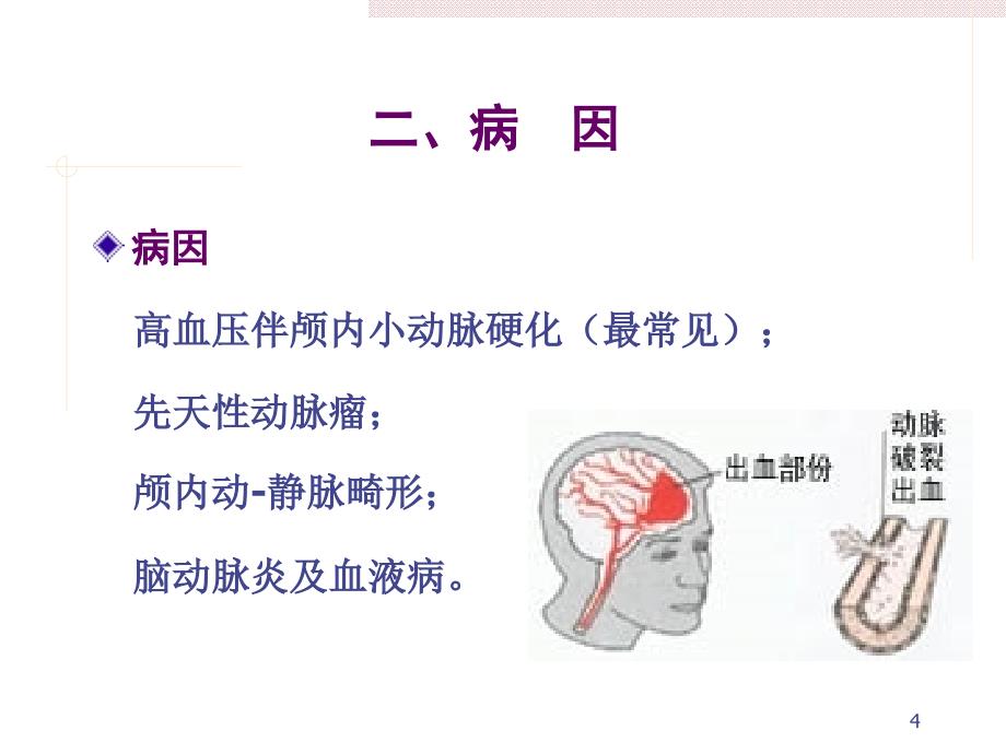 脑出血病人的护理_第4页