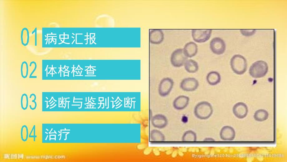 缺铁性贫血教学查房课件_第2页