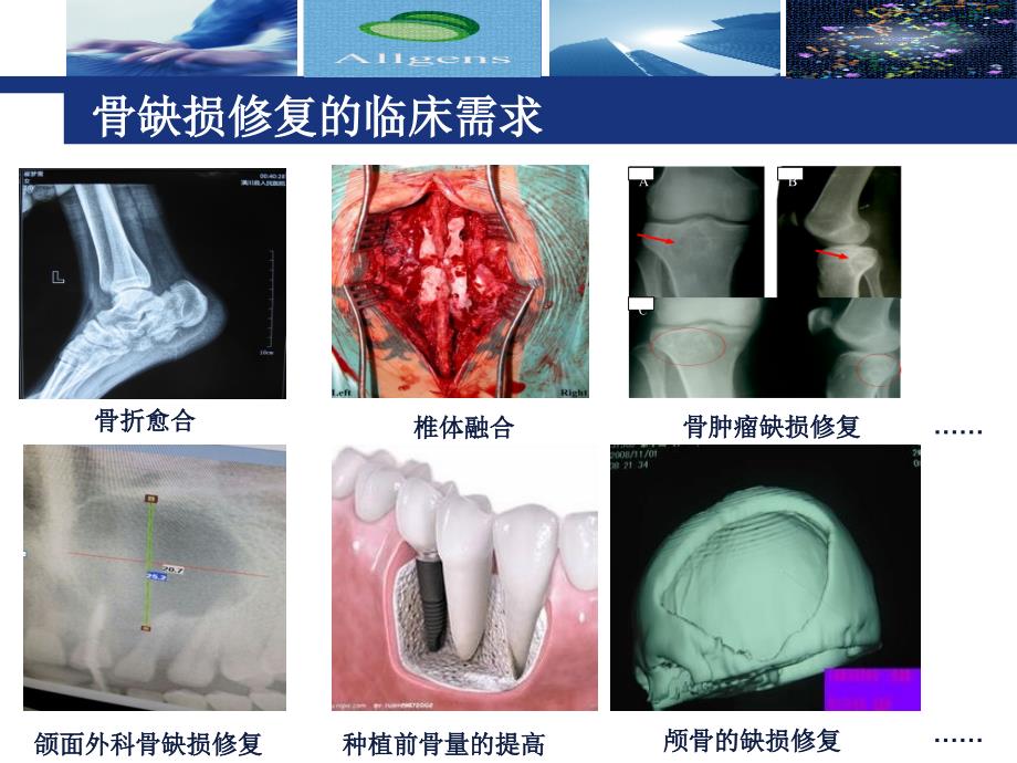 奥精骼金产品仿生骨介绍_第3页