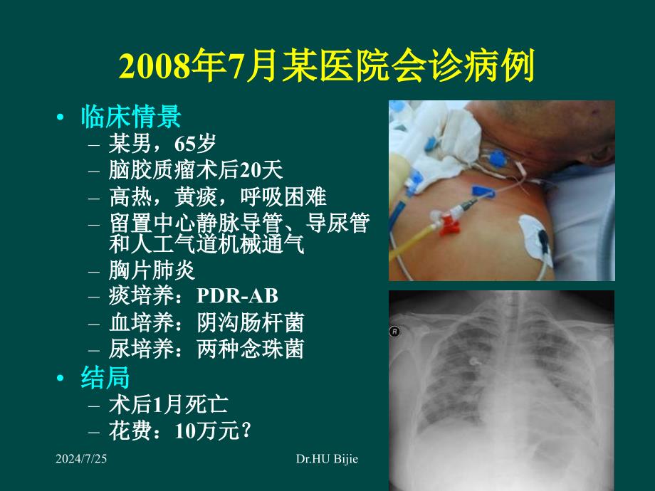 医院感染管理与防控的新理念新技术新进展胡必杰_第4页