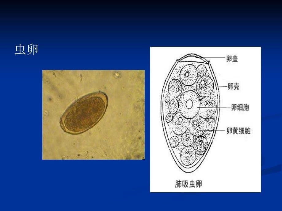 肺吸虫病例感想_第5页