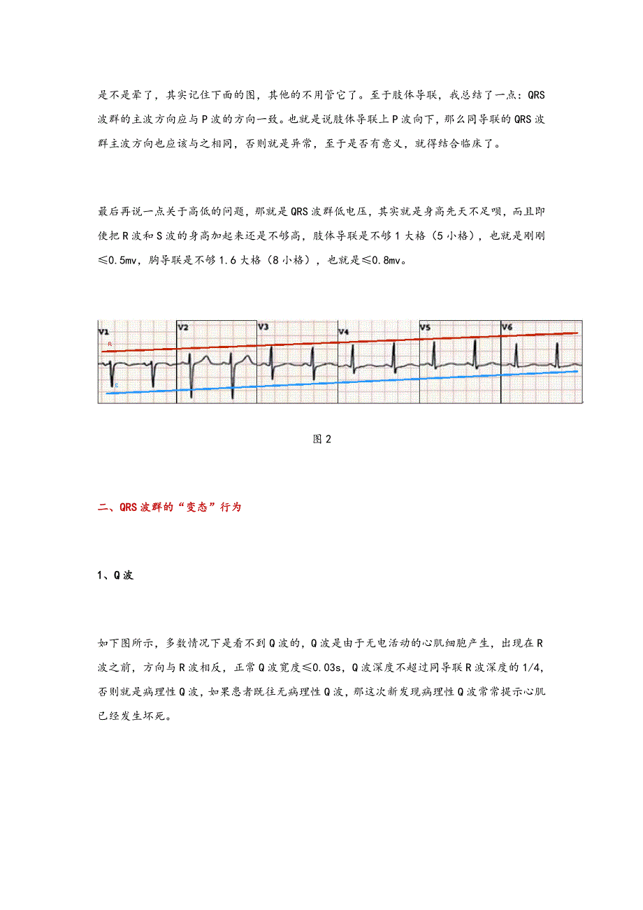 心电图QRS波群的五种_第3页