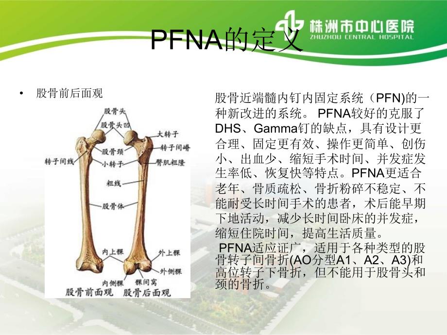 PFNA内固定术术后的护理查房课件_第2页