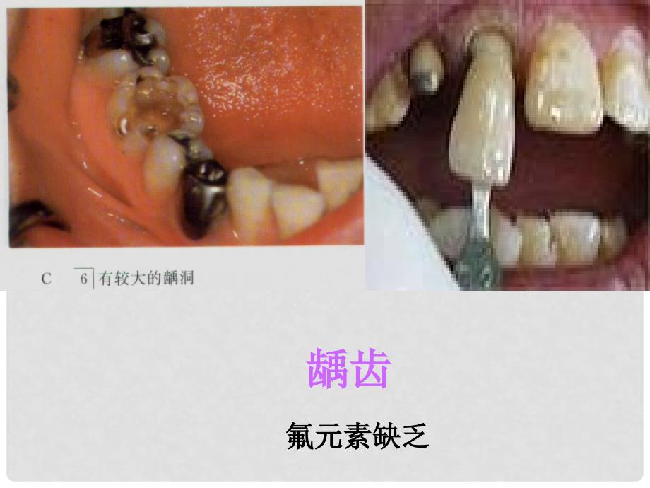 九年级化学第十二单元化学与生活课题二化学元素与人体健康课件人教版_第3页