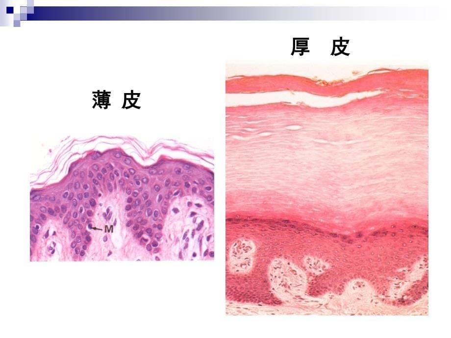 组织胚胎学教学资料第13章皮肤芬课件_第5页