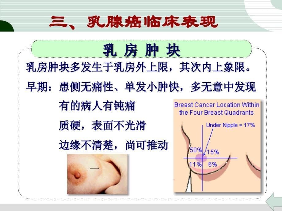 乳腺癌病人的护理治疗护理健康教育_第5页