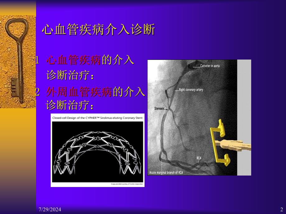 最新心血管疾病介入诊断治疗护理课件PPT课件_第2页