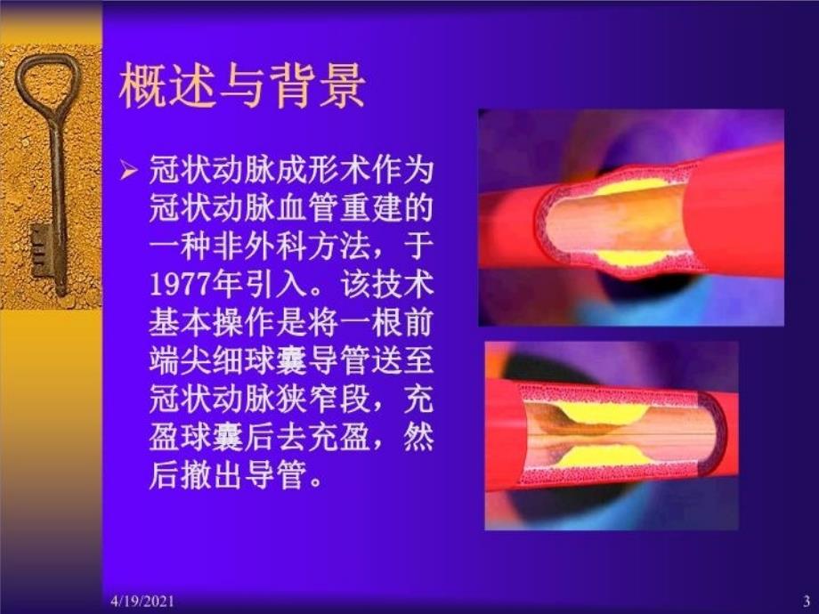 最新心血管疾病介入诊断治疗护理课件PPT课件_第3页