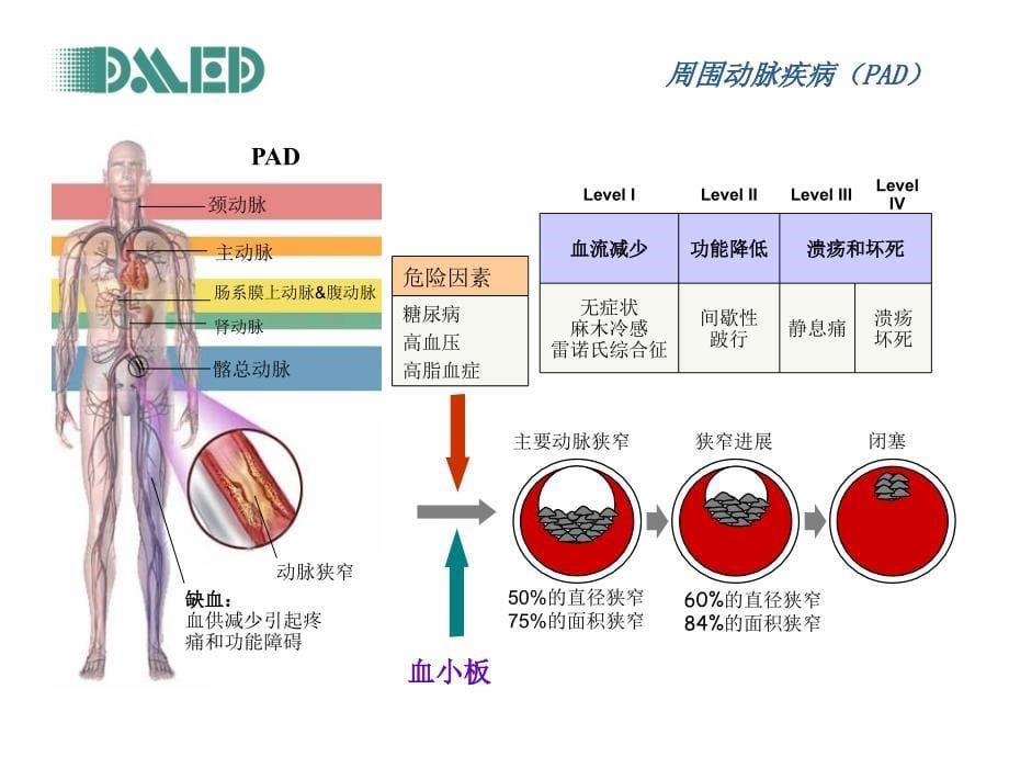 ABI(踝臂指数)检查课件_第5页