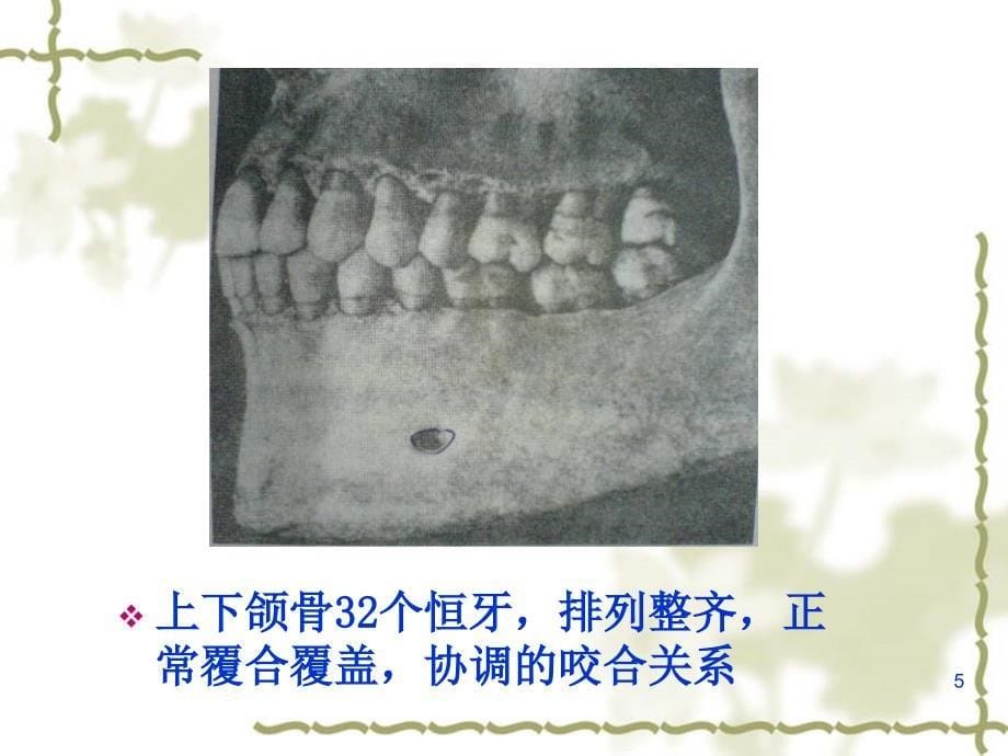 错牙合畸形的分类ppt课件_第5页