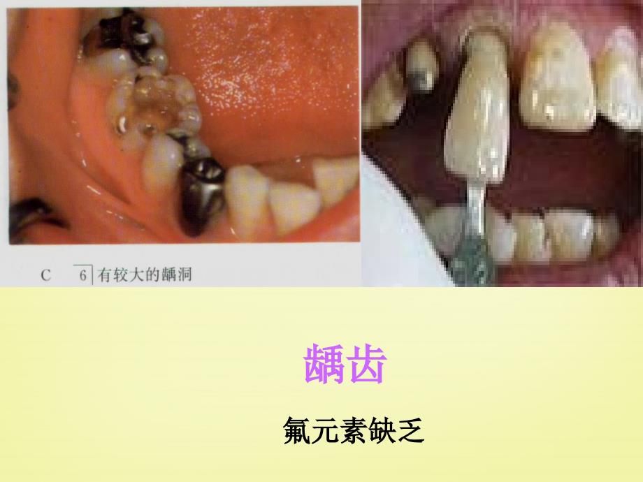 最新人教初中化学九下《12课题2化学元素与人体健康》PPT课件 11_第4页