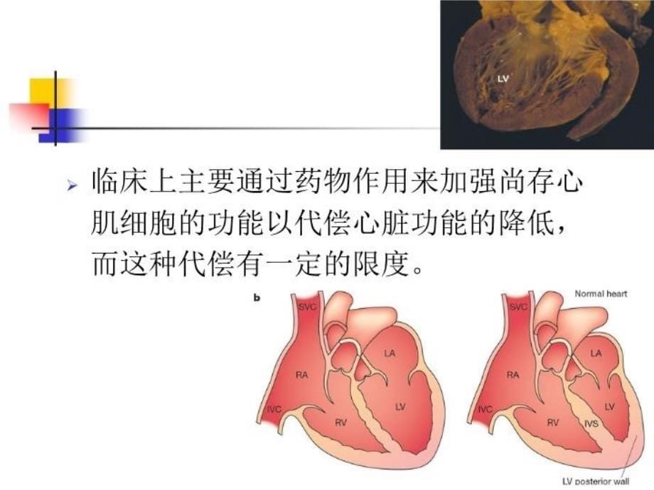 最新干细胞移植治疗弥漫性心脏功能损害的应用与进展PPT课件_第5页