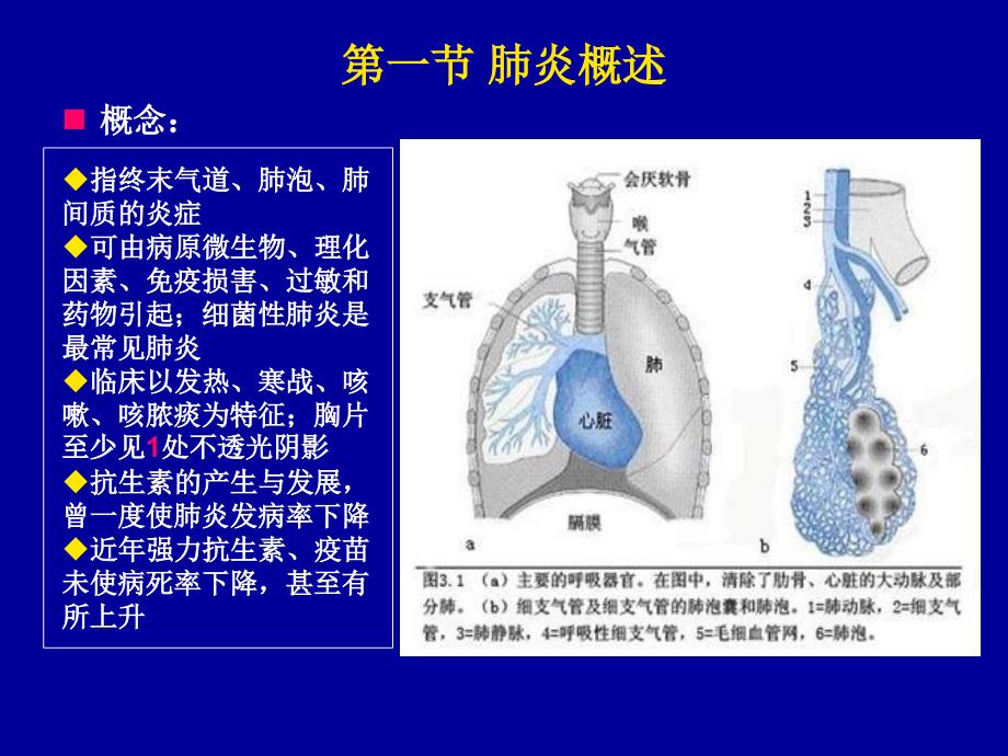 肺部感染性疾病诊治_第2页