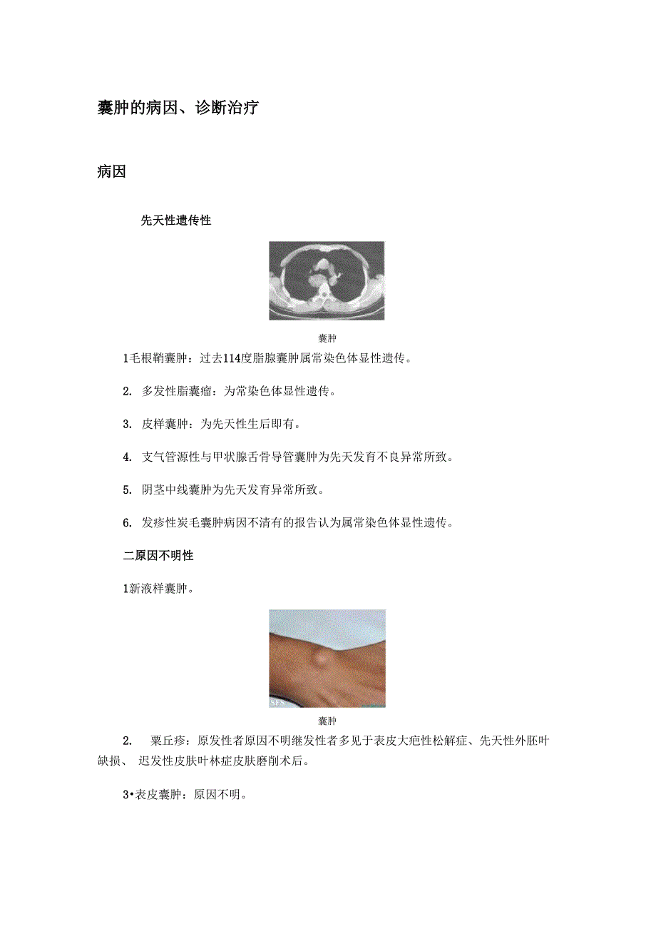 囊肿的病因、诊断治疗_第1页