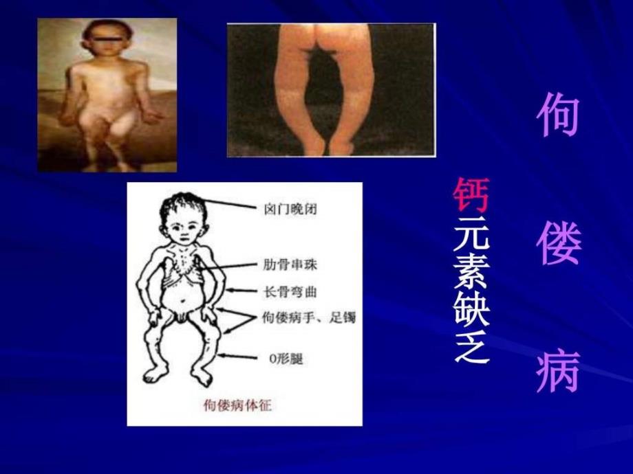 化学元素与人体健康人教版.ppt_第4页